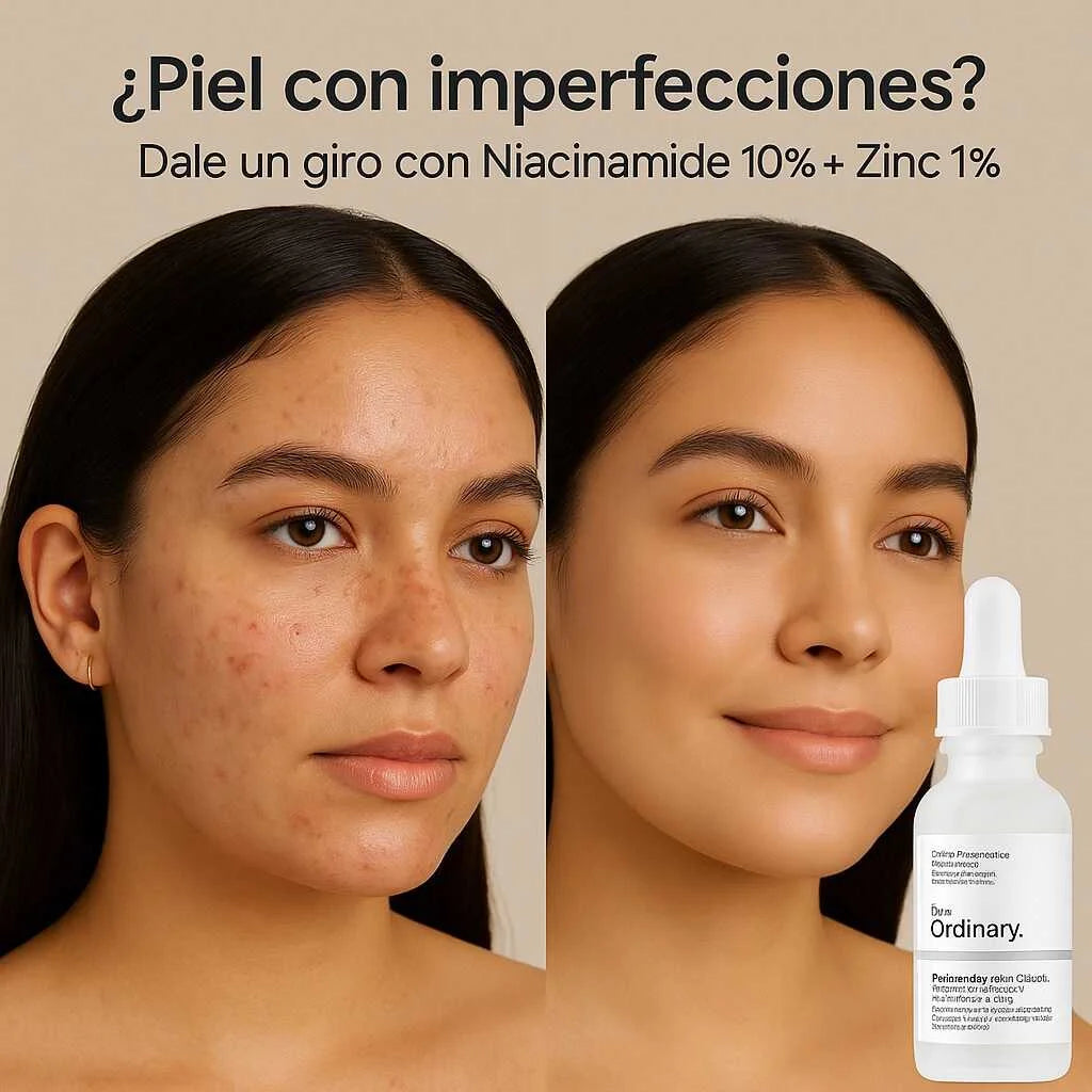 NIACINAMIDE 10% + ZINC 1%